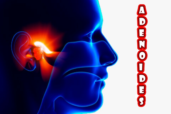 Adenoides