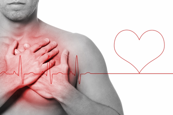 Angina de Pecho:
