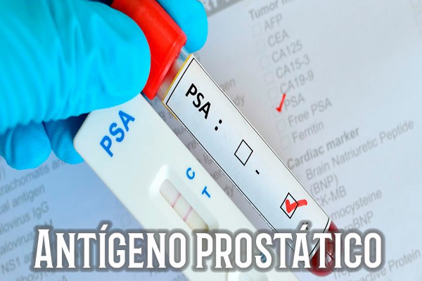 Antígeno prostático