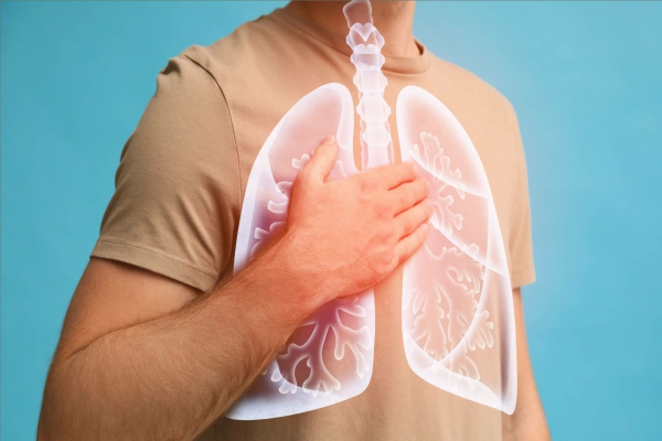 Bronquitis