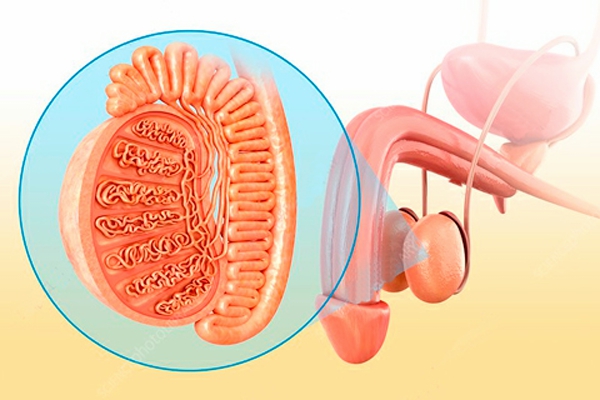 Cáncer de testículo