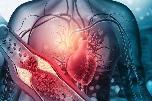 Cardiopatía