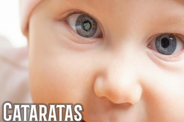 Cataratas