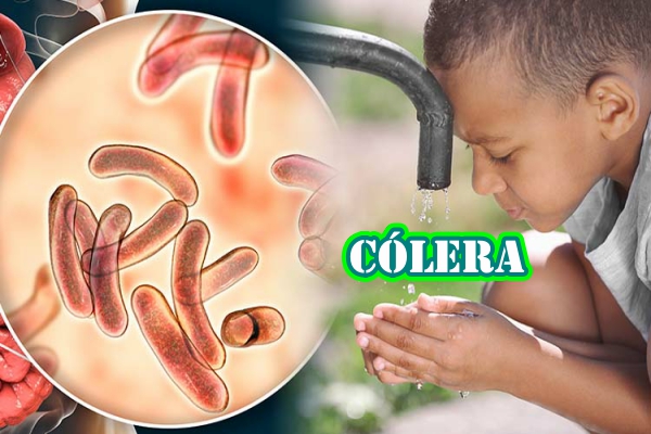 Cólera