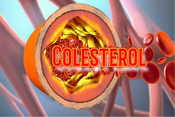 Colesterol