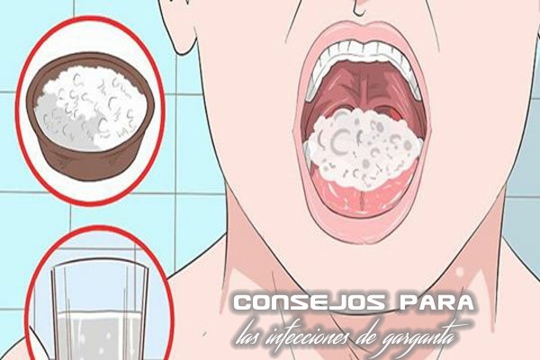 Consejos para las infecciones de garganta