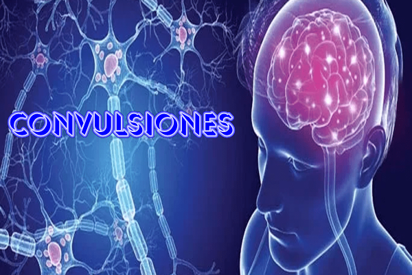 Convulsiones