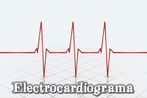 Electrocardiograma