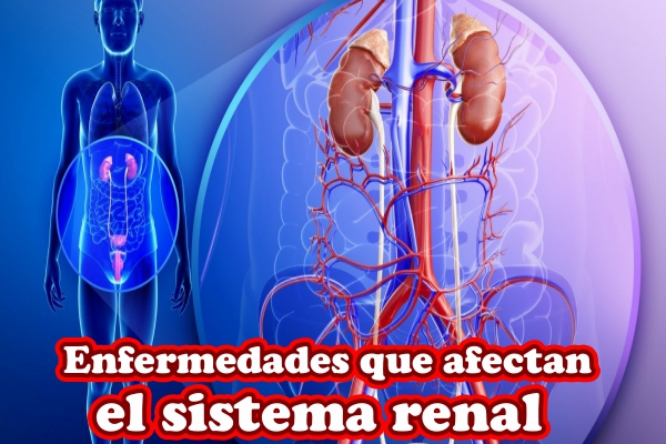 Enfermedades que afectan el sistema renal