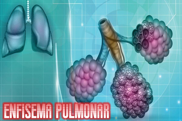 Enfisema pulmonar
