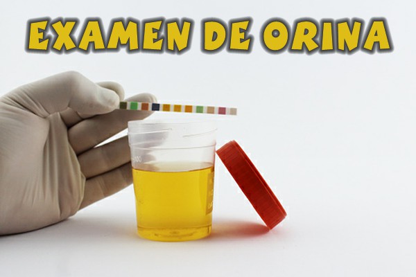 Examen de orina