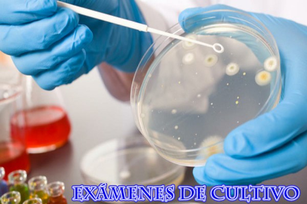 Exámenes de cultivo