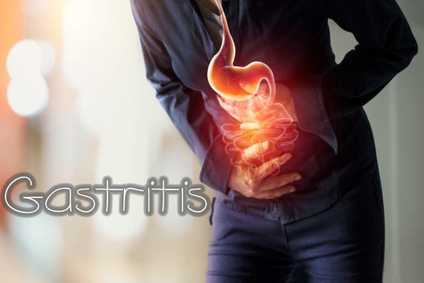 Gastritis