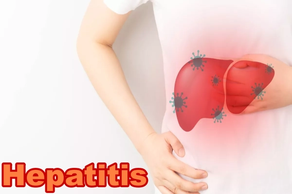 Hepatitis