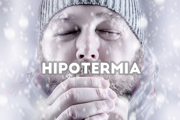 Hipotermia: Desglose Integral de una Condición Crítica