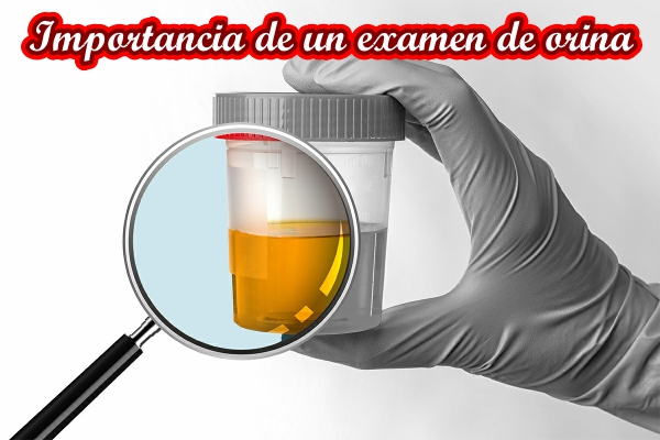 La Importancia del Examen de Orina en el Diagnóstico Médico