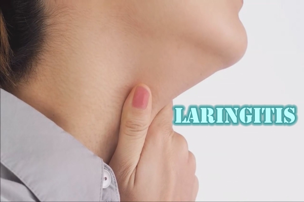 Laringitis