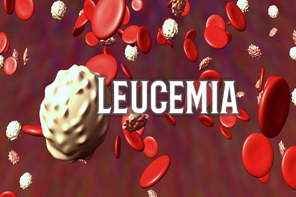 Leucemia