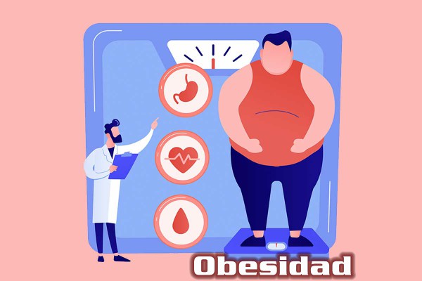 Obesidad