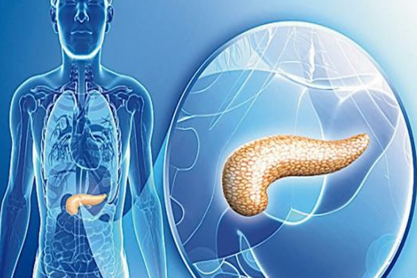 Pancreatitis crónica