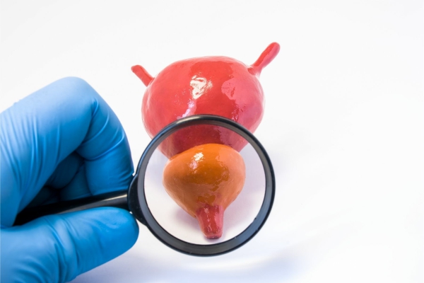 Prostatitis