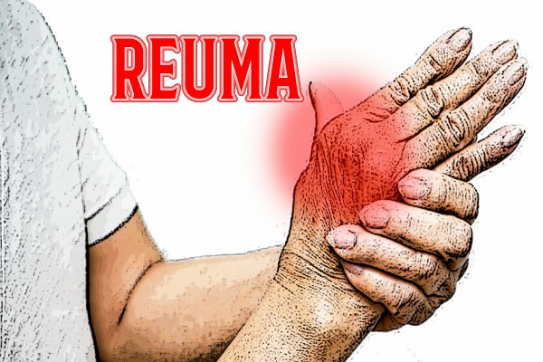 Reuma