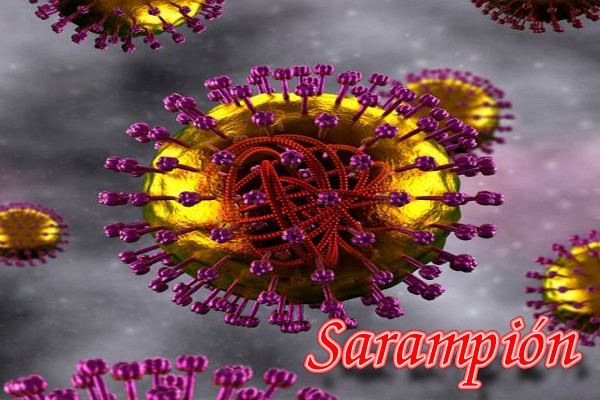 Sarampión