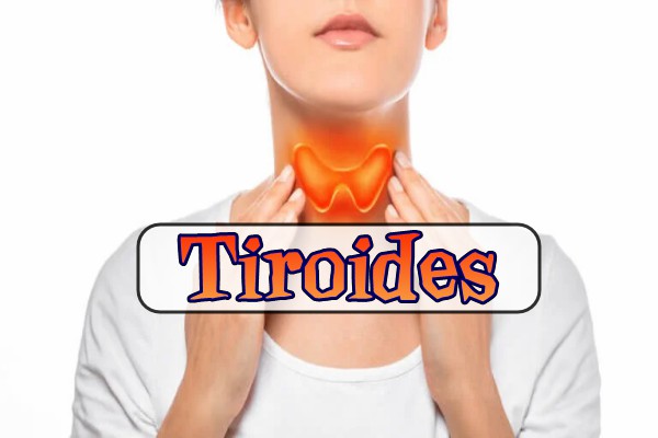 Tiroides