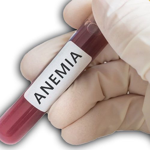 Anemia