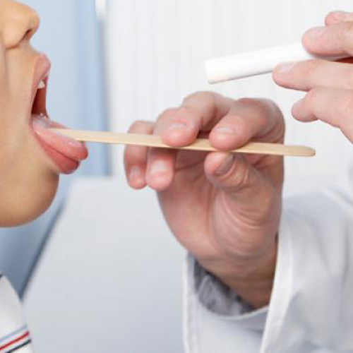 Rapid Strep Test